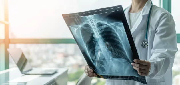 راتب أخصائي أشعة في السعودية