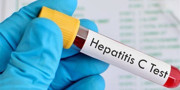 رابط نتيجة تحاليل المعامل المركزية برقم الجواز