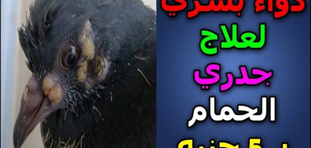 دواء بشري لعلاج جدري الحمام