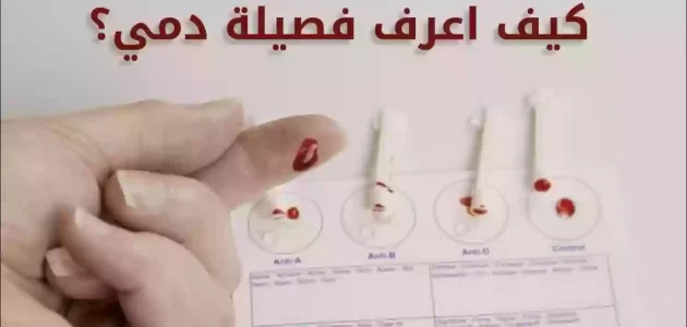 كيف اعرف فصيلة دمي من صحتي